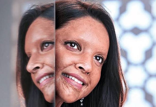 Chhapaak set to make its digital premiere on Hotstar VIP